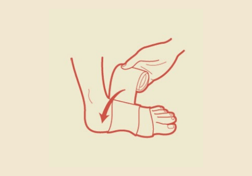 Lower leg Injuries and How you can Recover – Ankle Sprains Explained!