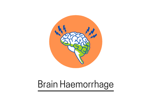 brain haemorrage