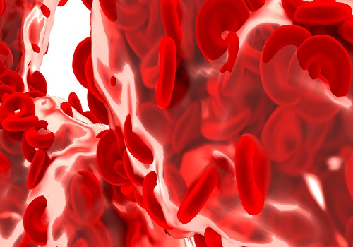 Peripheral Artery Disease (PAD) - Symptoms, Diagnosis, And Treatment
