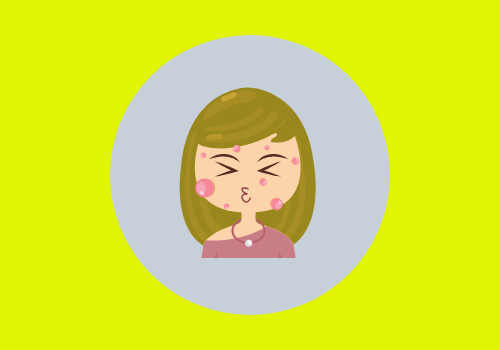What Do Skin Tags Signify?