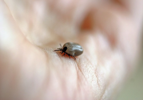 Lyme Disease - Symptoms, Causes, Diagnosis, And Treatment